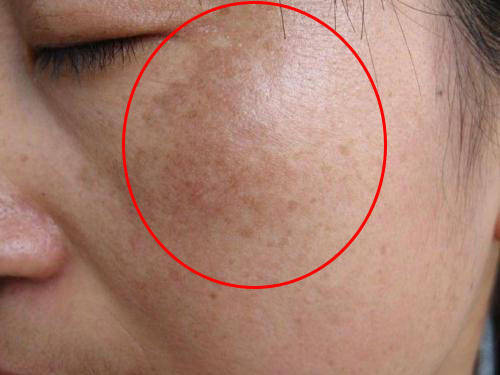 美丽女人的护肤宝典 色斑“畏惧”的1种食物,猕猴桃排名第4,每天坚持吃,让脸更白嫩