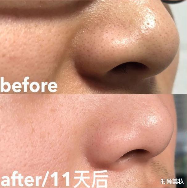 时尚美妆|金晨皮肤水润白皙，晋升新一代素颜女神，网友：太惊艳了