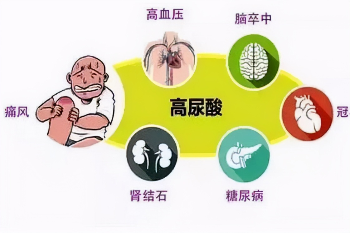 高尿酸血症|高尿酸血症,没症状!不痛不痒更可怕!避免食用的食物有哪些?