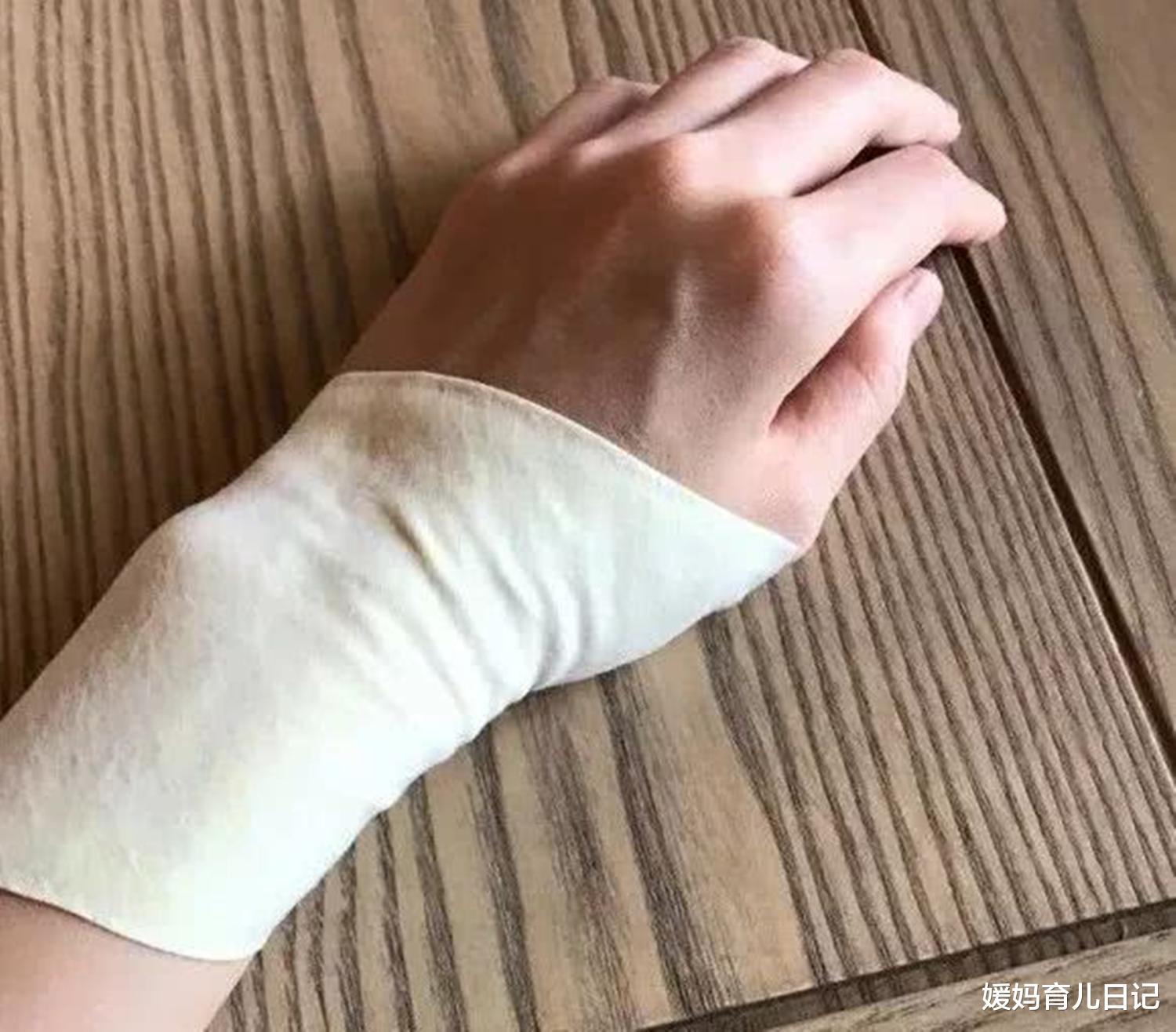 媛妈育儿日记|产后“妈妈手”背后,都是妈妈用力抱娃的勋章,却也是心酸