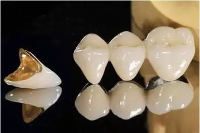 牙齿|常见的补牙材料带你来了解一下~