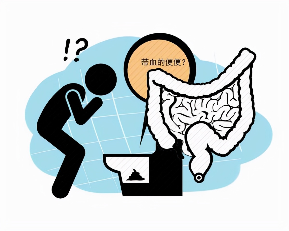 排便|提醒：排便时出现这4个异常，劝你最好第一时间，排查这3种癌症