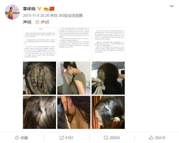 叶璇|真行！求家暴前男友复合，还悄悄生个娃？