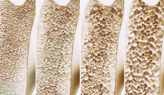 牛奶|吃一次相当于10瓶牛奶，呼吁：更年期女性可多吃，骨骼堪称“金刚骨”