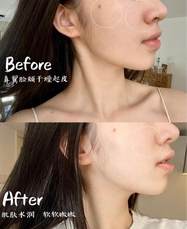 好物官|杭州女子为变美，自己注射“美白针”，结果“高烧不退”