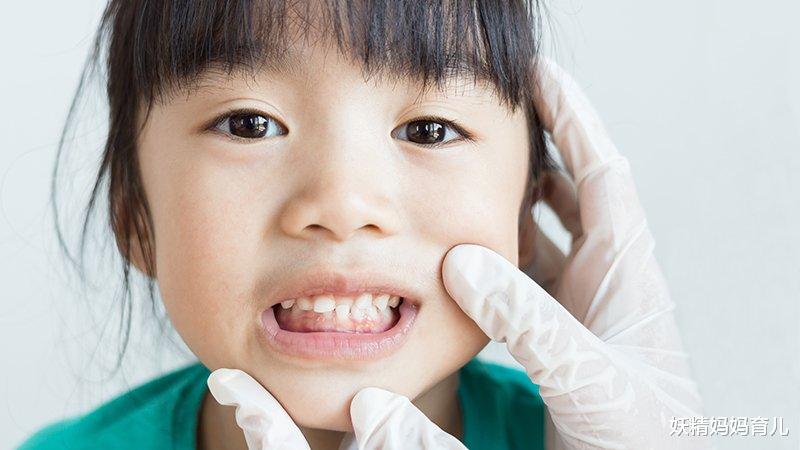 妖精妈妈育儿|不吃糖的宝宝，还蛀牙？牙科医生：打造防蛀体质，比不吃糖更重要