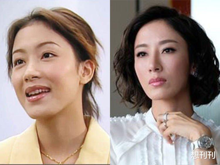 整容|整容风刮到香港，这7位港圈大美人竟跑去DO脸上，结局一言难尽