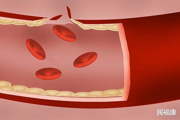 更年期|更年期是每位女性都要经历的阶段，当遇到时要有正确的处理方法