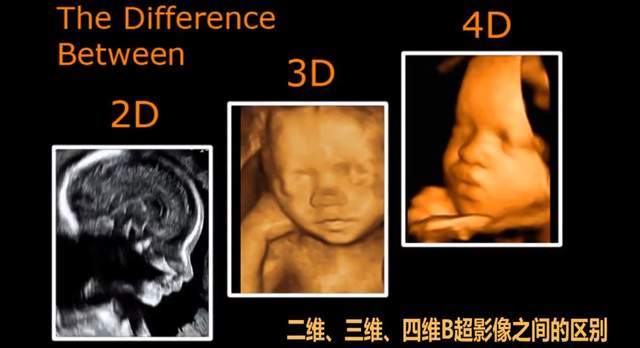 京妈说|?孕中期产检:重要项目及检查时间,关乎母子健康,一次都别落下