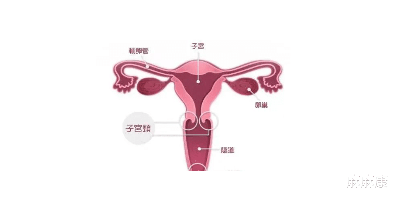 麻麻康|宫颈癌是什么原因引起的?这4种预防手段,很多人都遗漏了