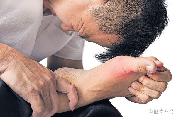 痛风|痛风反复发作，很困扰，医生提醒：可能是这6个因素惹的祸！