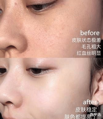 面霜|张馨予晒出用了3年的面霜，李佳琦：我用5年了，网友：堪称平价阿玛尼