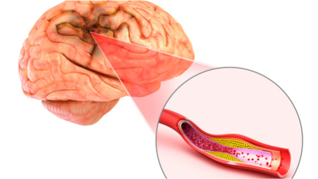 肝脏|脑部有血栓，头部会告知，提醒：大脑有4“怕”，改掉1件都加寿