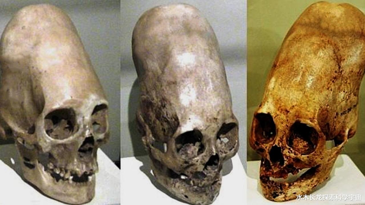 科学家发现在进化历程中人脑一直在萎缩,人类智力也在退化吗?