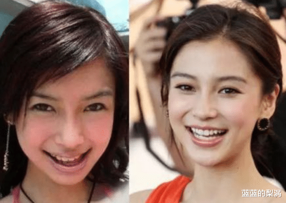 整容|有一种“整容”叫傅园慧，整牙后颜值逆袭，网友：原来杨颖没说谎