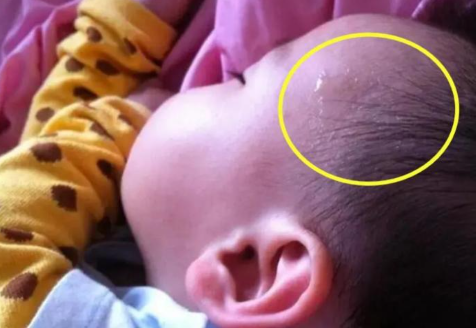 急诊室老苗|宝宝睡着就满头大汗，是因为“缺钙”吗？家长要学会判断