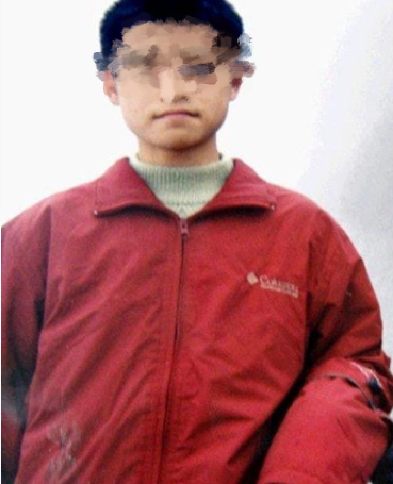 重庆19岁男生与女友分手被泼硫酸,面部毁容,?眼睛永久无法闭合