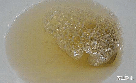 尿酸|尿酸“克星”被发现，比黑芝麻更护肾，没事吃一点，肾精足气色好