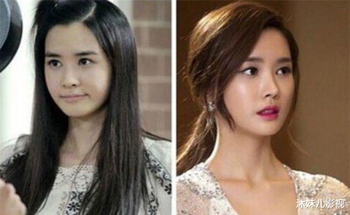 朱单伟|她是李易峰唯一承认的女友,美的不可方物,如今整容变成这般模样