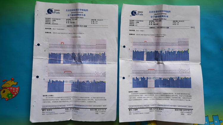 女子意外怀孕后不顾反对生下双胞胎,专家断言:活不过18岁!