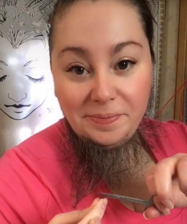 美国|美国女子毛发旺盛，曾感到很羞愧，如今大方晒出胡子觉得自豪