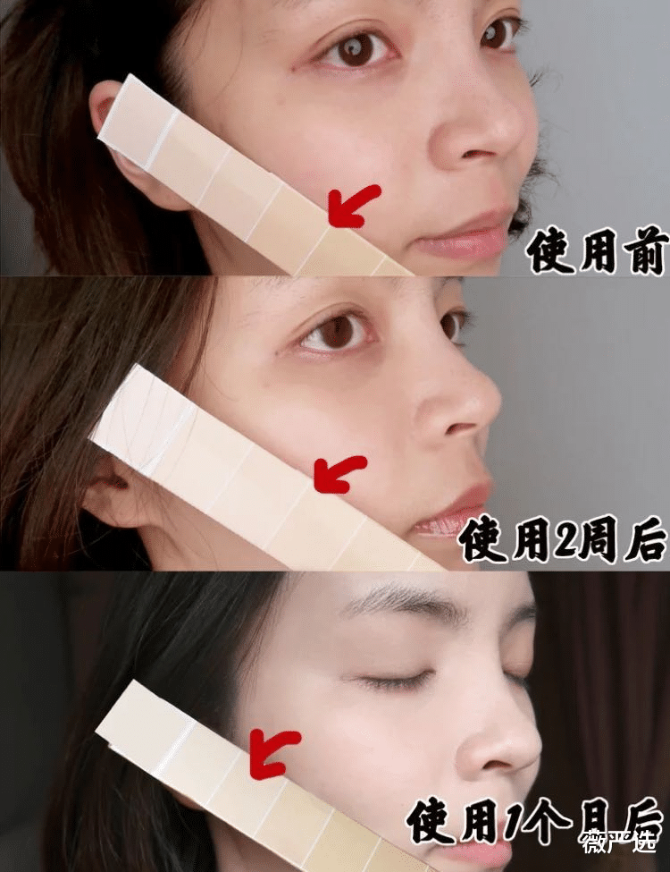 |丈夫：一夜之间你的脸怎么黑了？女子的美貌消失了，美白还需谨慎