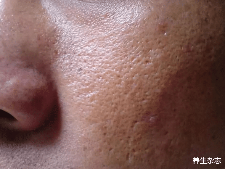 ct检查|肝毒“天敌”发现了,不是苦瓜,平时可劲吃,肝一天天变干净