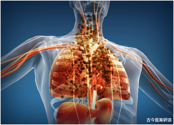 医生|肺不好，慢慢养，医生提醒：肺不好的人不妨多吃，排出肺毒，肺部焕然新生