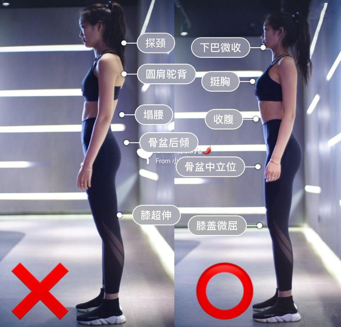 驼背|驼背、探颈和圆肩影响气质怎么办？加入针对性动作，改善不良体态