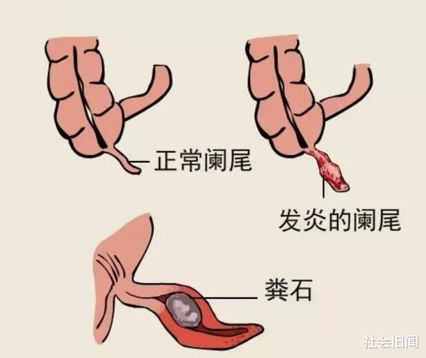 35%的人类已经进化,对比我们的猿猴祖先,现代人类新增了太多能力