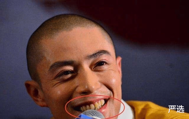 严选 牙黄口臭怎么办？用这一招，还你亮白牙齿和清醒新气