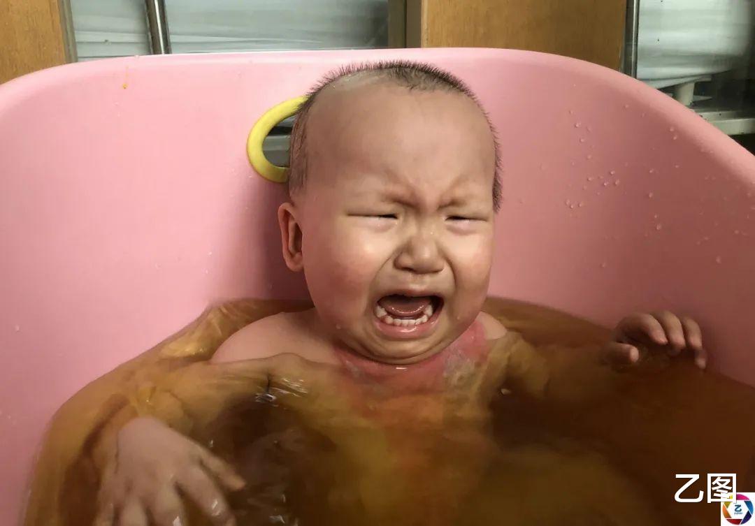 乙图 一岁血癌女童经历8次化疗，又被开水烫得遍体鳞伤，看着都痛