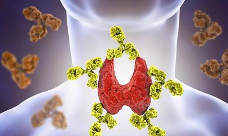 甲状腺疾病|以下这“4种”水果，可以有效帮助你的甲状腺保持健康，建议了解