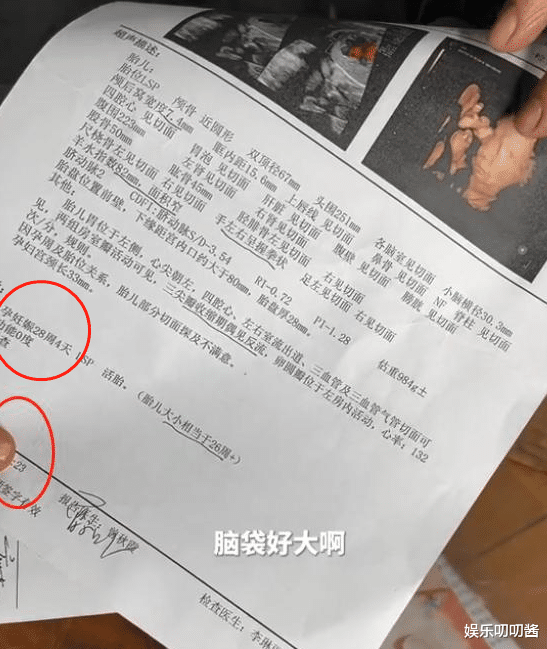 小春花怀孕28周不显怀,冒早产风险吃黄鳝,网友:一家戏精别当真