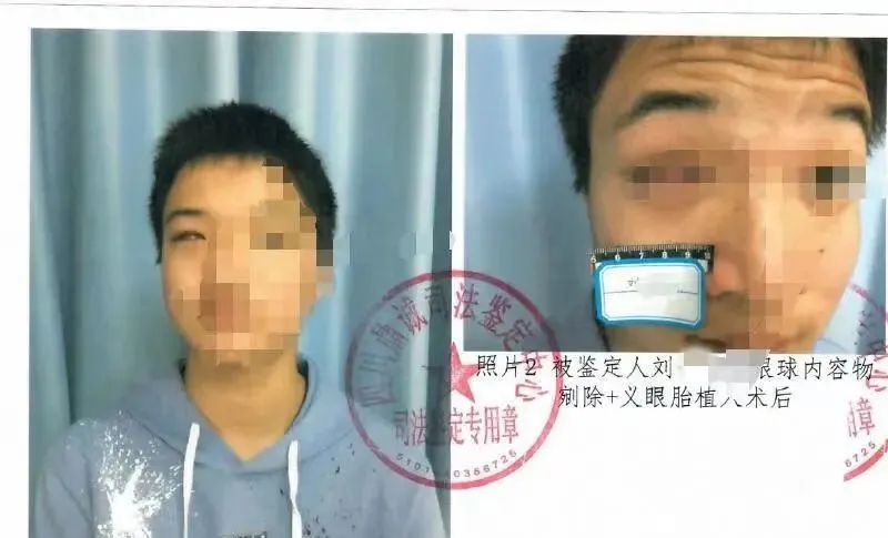 12岁男孩被女生踢裆致七级伤残下体切除?法院判决后,全网骂疯了
