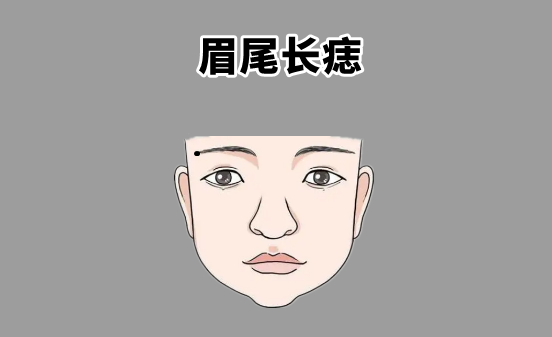 中国易经风水|“千金难买5颗痣”，一个增金，一个添福，天生皇帝命，福禄寿全！
