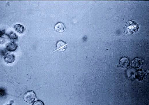 张医生科普|膝关节突然红肿热痛,夏季多见于这两种情况,该咋办?一起来看看吧