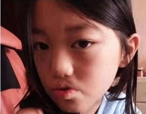 李嫣|李嫣不满闺蜜聚会遭曝光？放大正面照怼人，意外暴露唇部手术痕迹