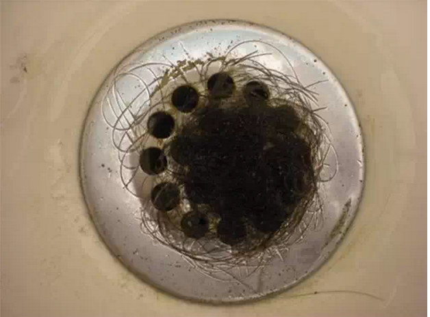 脱发|头发多久洗一次最合适？每天洗好不好？医生：这样洗才科学