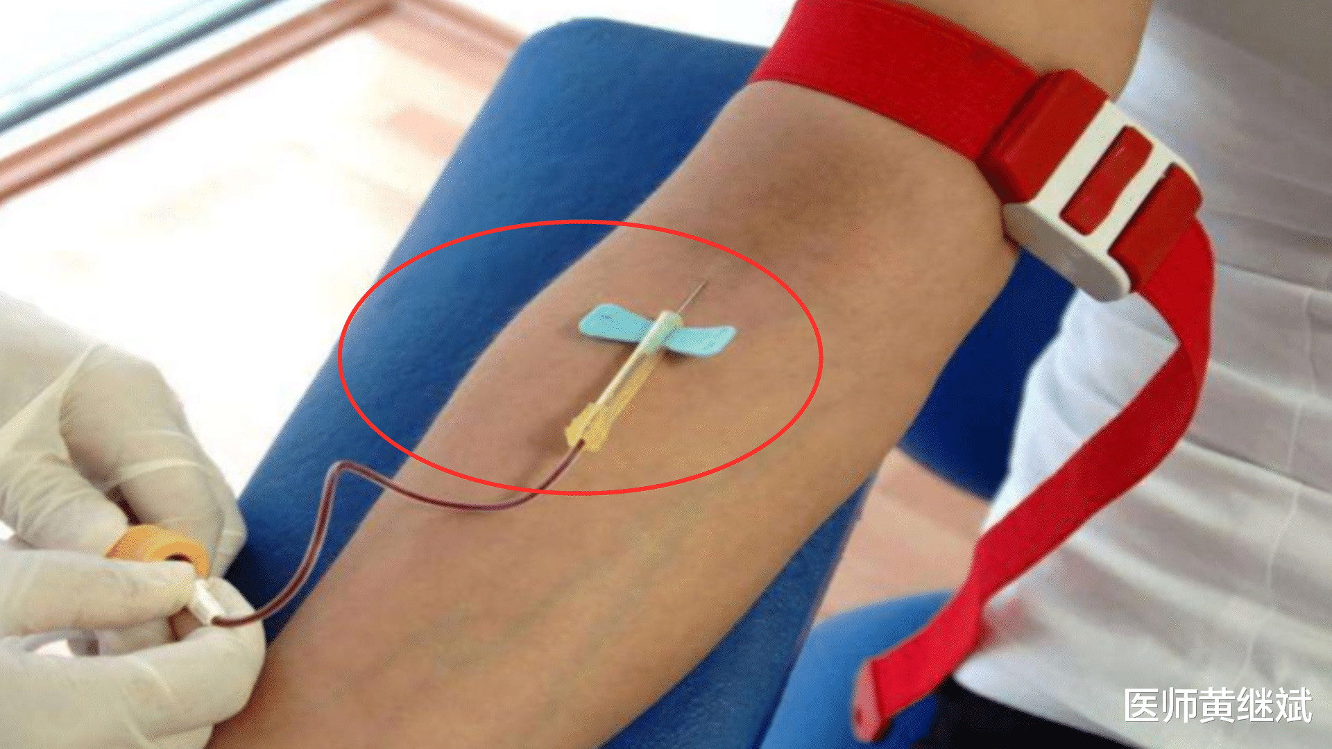 紫薯|两步走确诊细菌感染,还是病毒感染?医生来解读