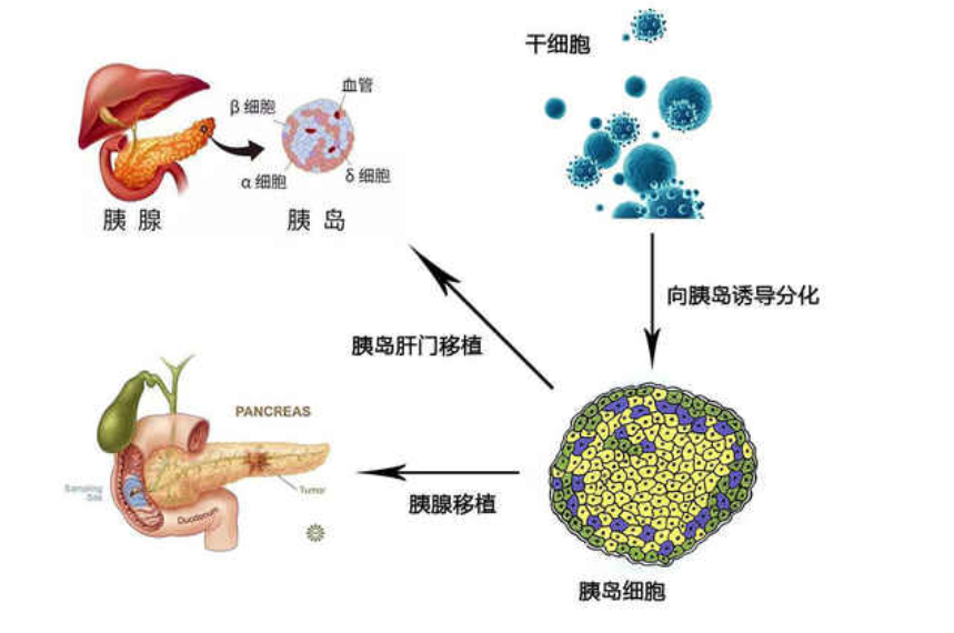 医学小栈|洋葱能降血糖？医生给出答案