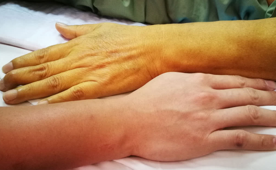 金兰中医学社|肝不好，不能吃葡萄？院士直言：真正伤肝的是这3种水果，别再往家提