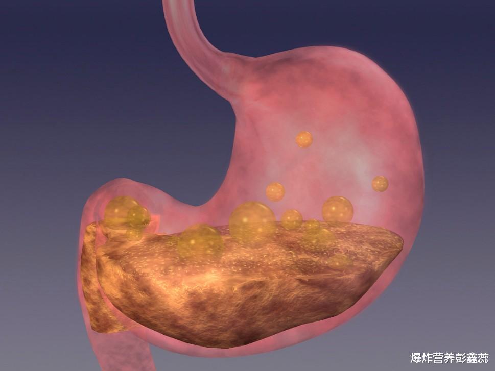 爆炸营养彭鑫蕊 2020年癌症调查数据：新发胃癌患者48万，想要远离坚持4个习惯