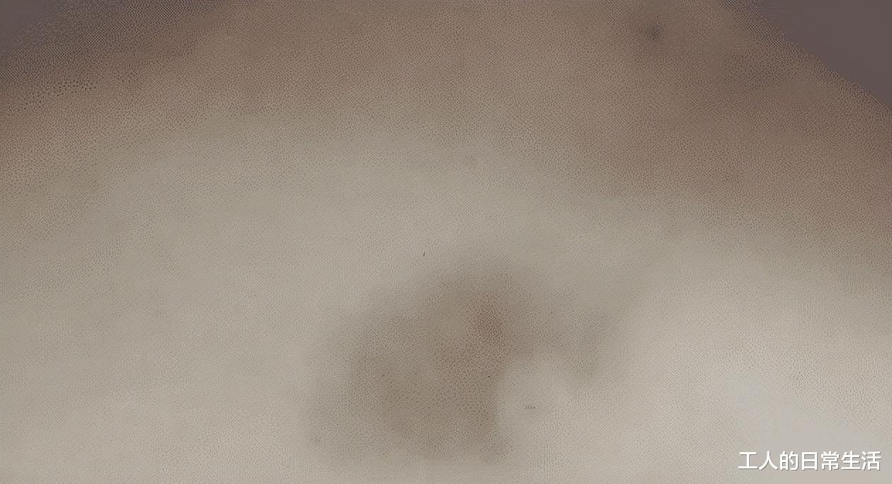 “蚊子把淤血吸走了,这是什么操作?”蚊子:这血有点过期...