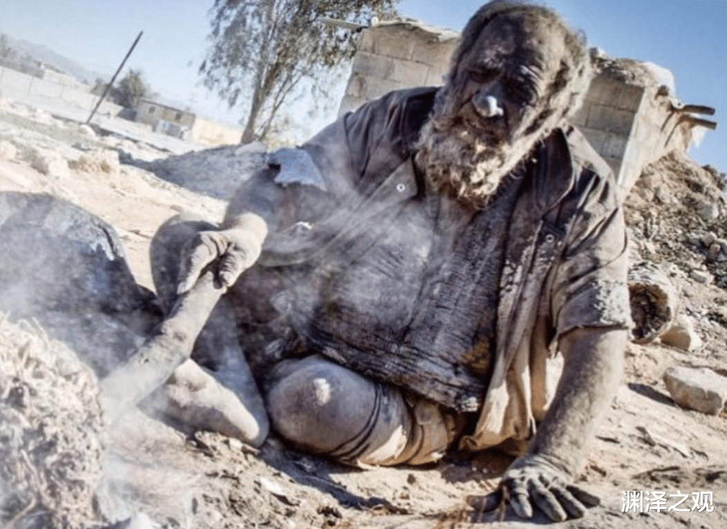 吉尼斯世界纪录|吉尼斯纪录保持者哈吉：60年没有洗过澡，身体像是穿了铠甲一样