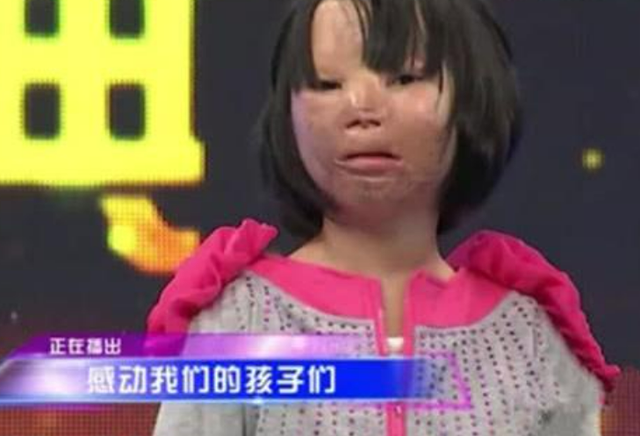 女孩从小就戴头套上学,受尽嘲笑与侮辱,摘下头套后全体沉默