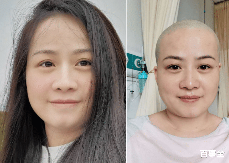 岳云鹏|岳云鹏老婆也开始炫富了？一件上衣上万元，曾为治病剃光头发