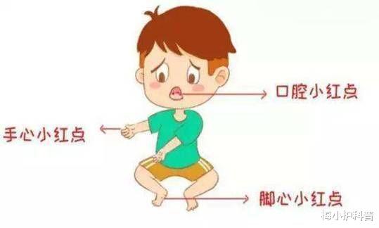 梅小护科普 自费的手足口疫苗，有没有必要打？