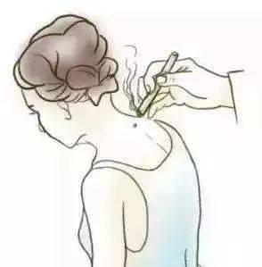 医生|你知道秋天艾灸的好处吗