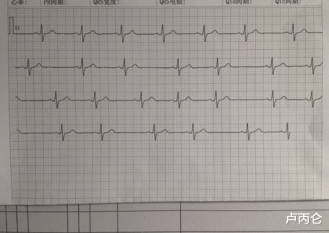 体检|体检查出以下10种问题别着急，观察就可以
